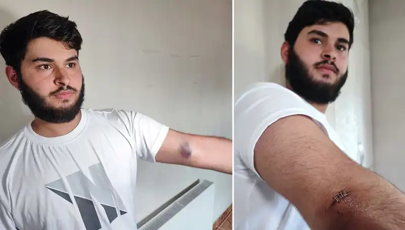 Bahçeye Kaçan Top, Mahallede Eğlenceli Kaos Yarattı