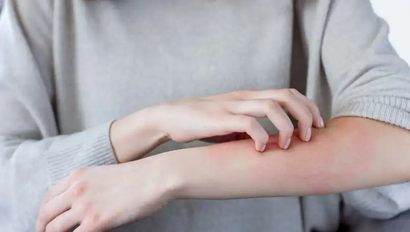 Cilt Kanserinin Gizli Belirtileri: Dermatologdan Şaşırtan Açıklamalar